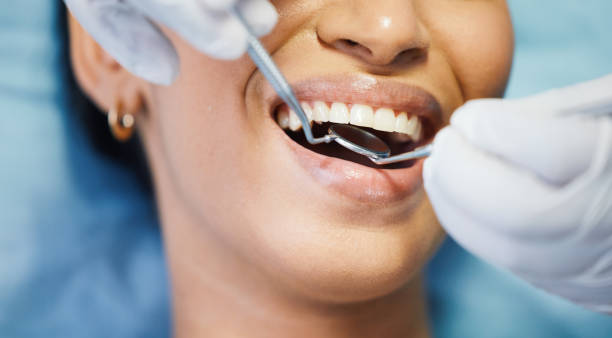 Best Broken or Cracked Tooth Emergency Dentist in Brookhaven, GA
